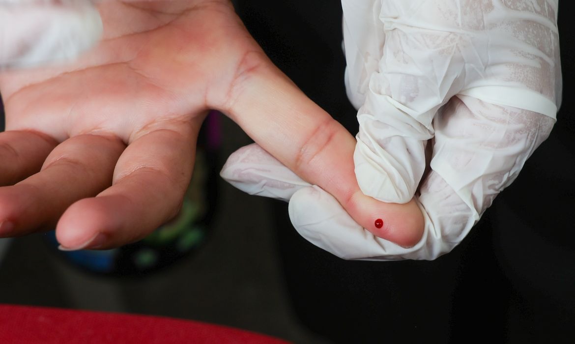 Brasil cumpre meta de prevenção da hepatite B
