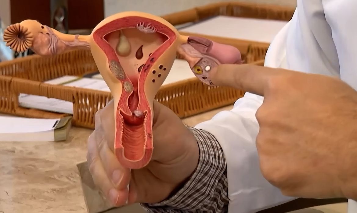Pesquisas sobre endometriose recebem R$ 60 milhões do CNPq