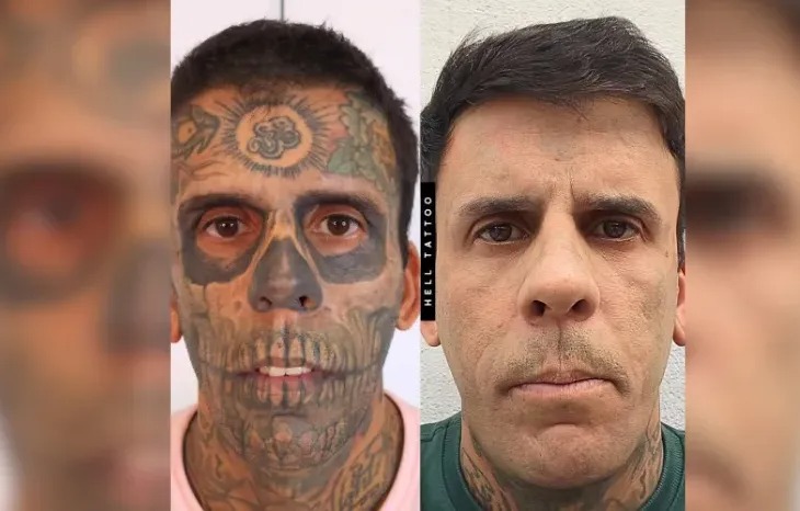 Homem Mais Tatuado do Brasil Faz Apelo Para Tratar Tumor